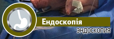 Ендоскопія