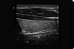 uprobe-ph-2